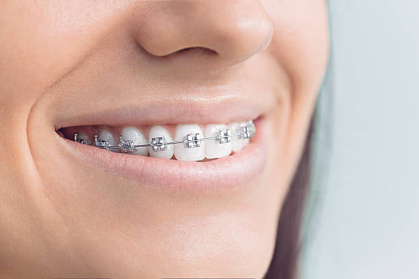 Best Invisalign and Clear Aligners  in Jemison, AL